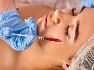 Exploring ELLANSE M 2×0.5ML