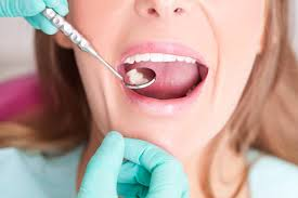 Routine Teeth Cleaning